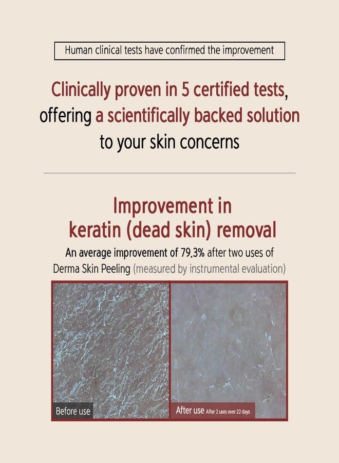 BQCELL [BQCELL] [Made In Korea] [DERMA SKIN PEELING 2g / Recell Cure Serum 2ml, Safety Cap 1ea, 3set], Acne Skin Available, Exfoliating, Facial Scrub, Korean Beauty, Blackhead Remover - Image 4